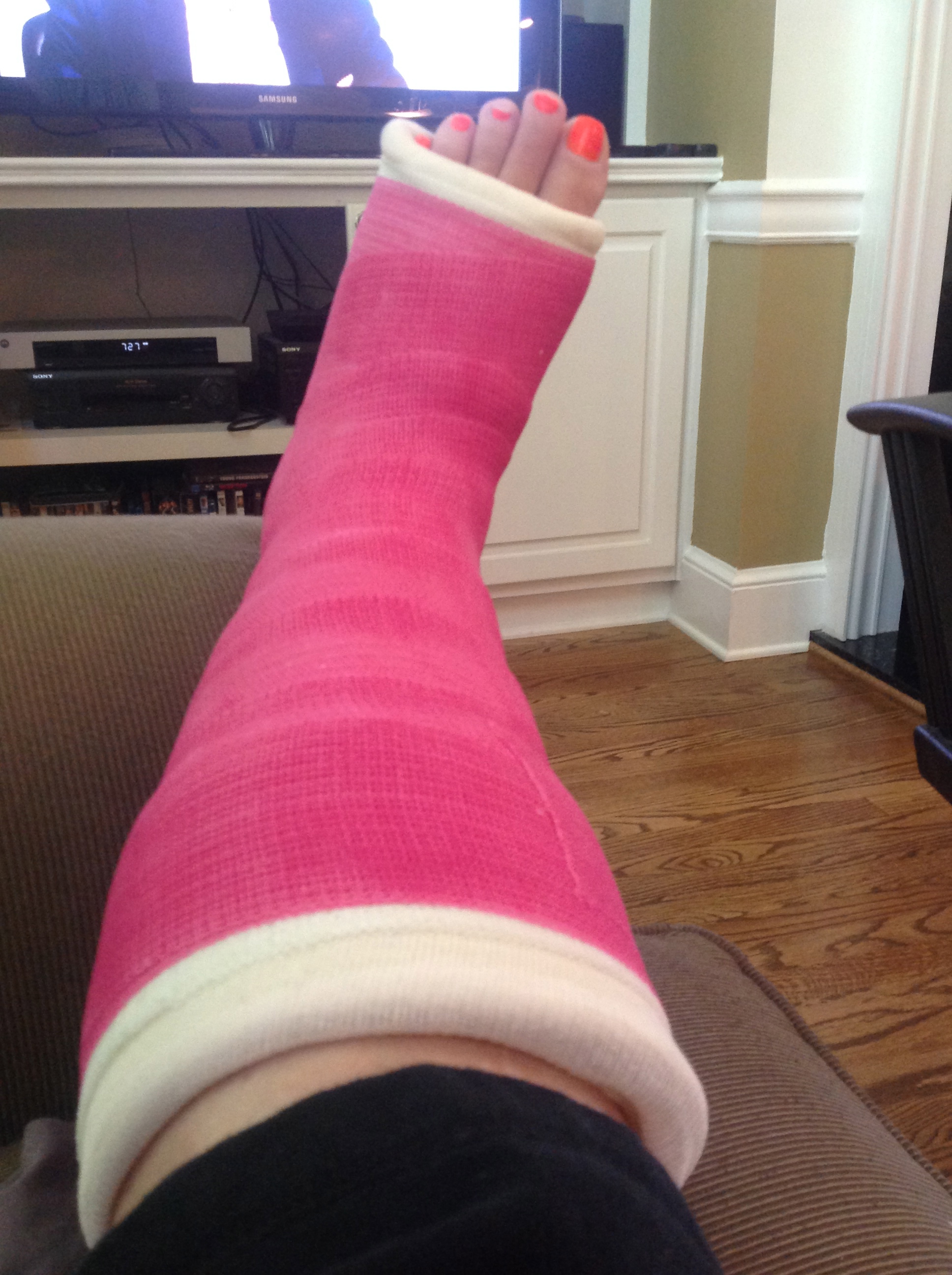 broken ankle pink cast