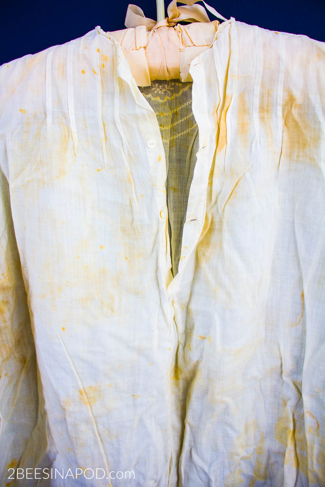 how to get yellow stains out of white